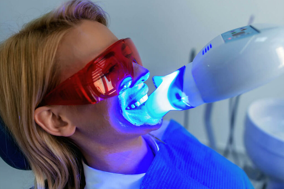 teeth whitening